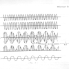 THEORIE 31 - SUPERHETERODYNE page-0005